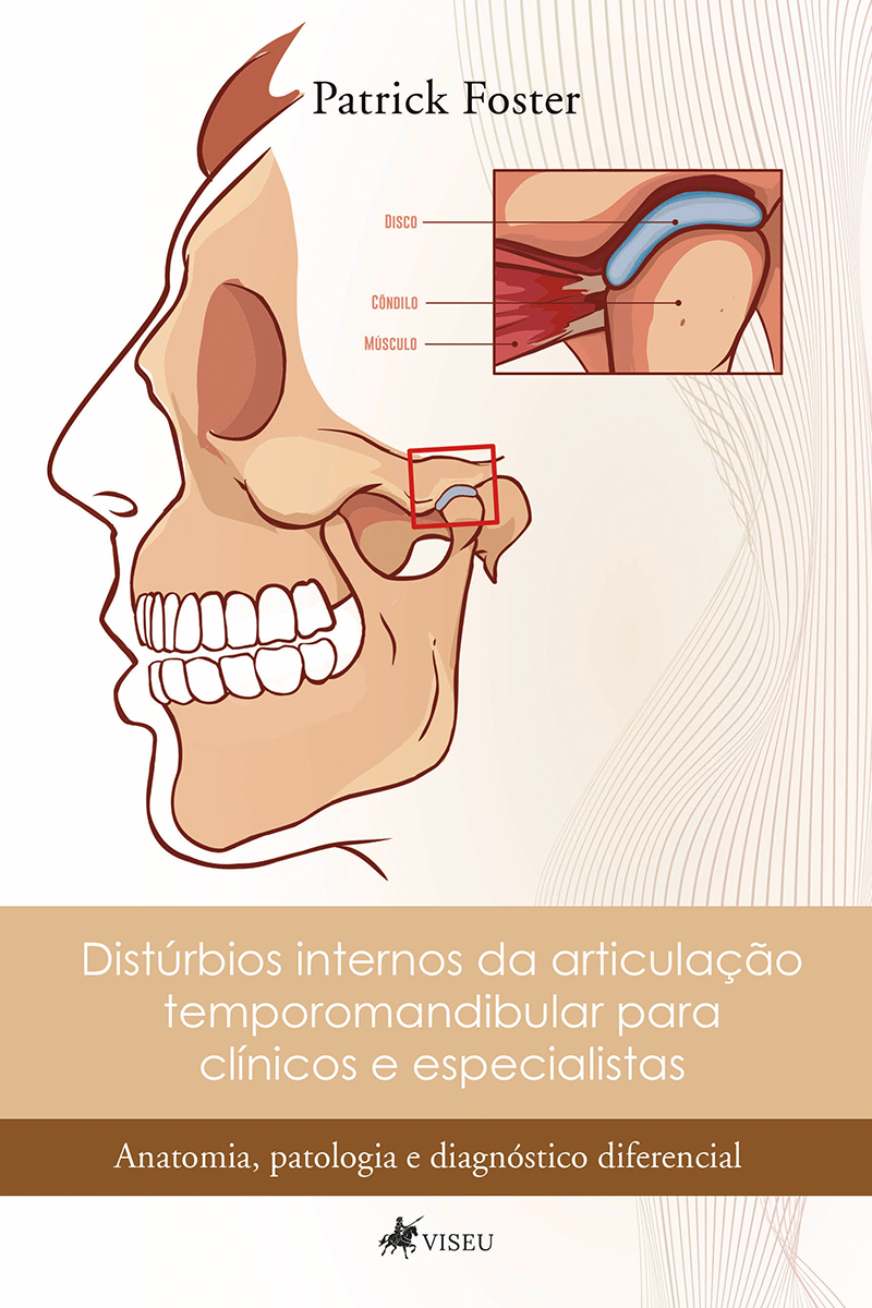 Distúrbios internos da articulação temporomandibular para clínicos e especialistas: Anatomia, patologia e diagnóstico diferencial